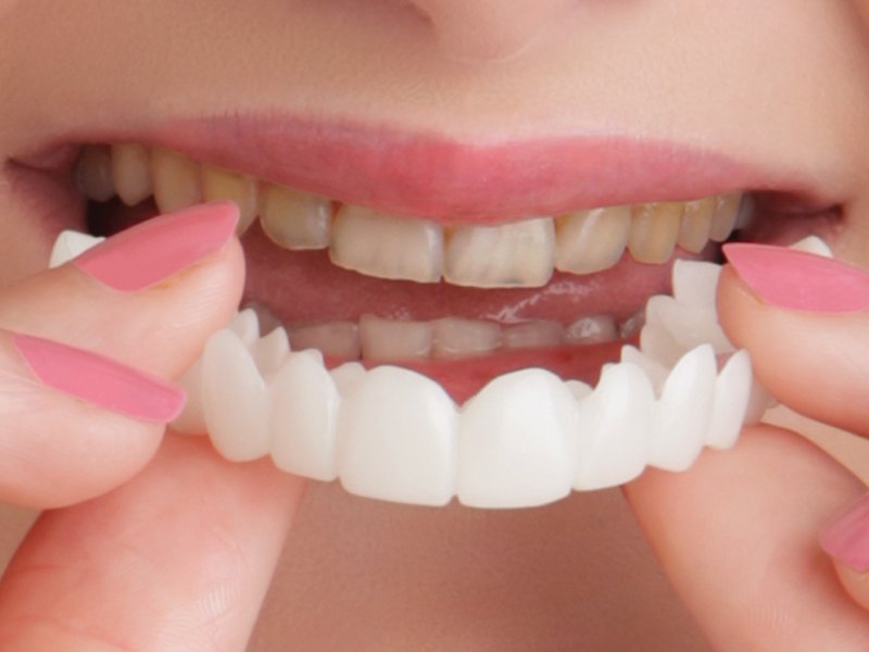 Snaponsmile™- Yeni Gülüşünüz