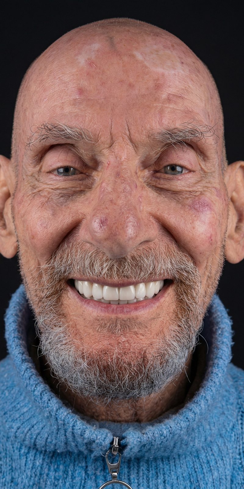 Snaponsmile takılıyken aynı gülüş