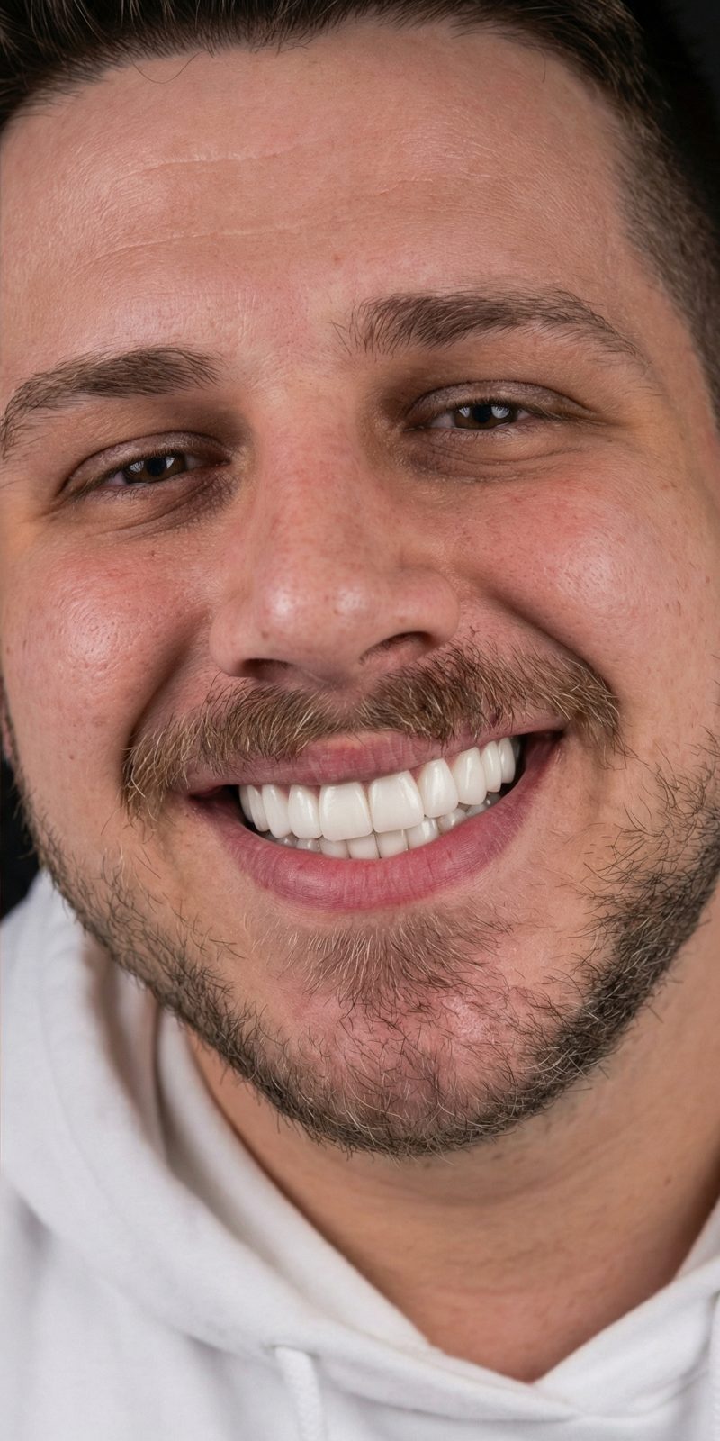 Snaponsmile takılıyken aynı gülüş